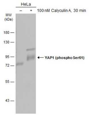 Western Blot: YAP1 [p Ser61] Antibody [NBP3-13319]